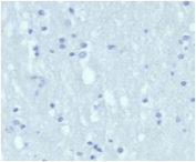 Negative control: IHC staining of FFPE human brain tissue with recombinant KRT7 antibody (clone KRT7/4387R) at 2ug/ml in PBS for 30min RT. HIER: boil tissue sections in pH 9 10mM Tris with 1mM EDTA for 20 min and allow to cool before testing.
