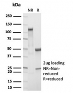 SDS-PAGE analysis of purified, BSA-free recombinant Retinol Binding Protein 4 antibody (clone RBP4/7045R) as confirmation of integrity and purity.