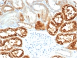 IHC staining of FFPE human kidney tissue with recombinant Retinol Binding Protein 4 antibody (clone RBP4/7045R). HIER: boil tissue sections in pH 9 10mM Tris with 1mM EDTA for 20 min and allow to cool before testing.