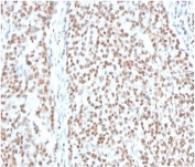 IHC staining of FFPE human colon tissue with RPA32 antibody (clone RPA2/4774). HIER: boil tissue sections in pH 9 10mM Tris with 1mM EDTA for 20 min and allow to cool before testing.
