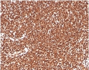 IHC staining of FFPE human colon tissue with RPA32 antibody (clone RPA2/4774). HIER: boil tissue sections in pH 9 10mM Tris with 1mM EDTA for 20 min and allow to cool before testing.