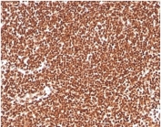 IHC staining of FFPE human colon tissue with RPA32 antibody (clone RPA2/4774). HIER: boil tissue sections in pH 9 10mM Tris with 1mM EDTA for 20 min and allow to cool before testing.