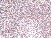 IHC staining of FFPE human tonsil tissue with RPA32 antibody (clone RPA2/4774). HIER: boil tissue sections in pH 9 10mM Tris with 1mM EDTA for 20 min and allow to cool before testing.