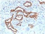 IHC staining of FFPE human lung tissue with recombinant Surfactant Protein D antibody (clone SFTPD/7084R). HIER: boil tissue sections in pH 9 10mM Tris with 1mM EDTA for 20 min and allow to cool before testing.
