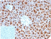 IHC staining of FFPE human pancreas tissue with recombinant FSCN1 antibody (clone rFSCN1/6464) at 2ug/ml in PBS for 30min RT. Cytoplasmic staining observed. Negative control inset: PBS used instead of primary antibody to control for secondary Ab binding. HIER: boil tissue sections in pH 9 10mM Tris with 1mM EDTA for 20 min and allow to cool before testing.