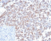 IHC staining of FFPE human tonsil tissue with SPARC antibody (clone OSTN/3933). Negative control inset: PBS instead of primary antibody to control for secondary binding. HIER: boil tissue sections in pH 9 10mM Tris with 1mM EDTA for 20 min and allow to cool before testing.