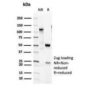 SDS-PAGE analysis of purified, BSA-free recombinant Surfactant protein D antibody (clone SFTPD/7085R) as confirmation of integrity and purity.