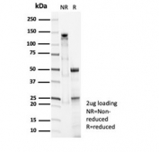 SDS-PAGE analysis of purified, BSA-free SFTPD antibody (clone SFTPD/7086R) as confirmation of integrity and purity.
