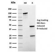 SDS-PAGE analysis of purified, BSA-free recombinant SHBG antibody (clone rSHBG/245) as confirmation of integrity and purity.