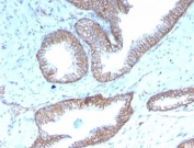 IHC staining of FFPE human prostate tissue with recombinant SHBG antibody (clone rSHBG-245). HIER: boil tissue sections in pH 9 10mM Tris with 1mM EDTA for 20 min and allow to cool before testing.