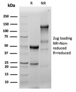 SDS-PAGE analysis of purified, BSA-free recombinant Fascin 1 antibody (clone FSCN1/6465R) as confirmation of integrity and purity.