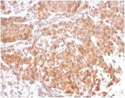 IHC staining of FFPE human prostate tissue with Superoxide Dismutase 1 antibody (clone SOD1/3923) at 2ug/ml in PBS for 30min RT. HIER: boil tissue sections in pH 9 10mM Tris with 1mM EDTA for 20 min and allow to cool before testing.