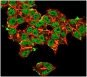 Immunofluorescent staining of PFA-fixed human MCF-7 cells Superoxide Dismutase 1 antibody (green, clone SOD1/3923) and phalloidin (red).