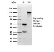 SDS-PAGE analysis of purified, BSA-free Superoxide Dismutase 1 antibody (clone SOD1/3923) as confirmation of integrity and purity.