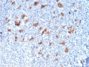 IHC staining of FFPE human tonsil tissue with SPARC antibody (clone OSTN/3932). Negative control inset: PBS used instead of primary antibody to control for secondary Ab binding. HIER: boil tissue sections in pH 9 10mM Tris with 1mM EDTA for 20 min and allow to cool before testing.