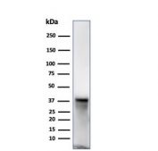 Western blot testing of human JEG-3 cell lysate using SPARC antibody (clone OSTN/3932). Expected molecular weight: 35-43 kDa depending on glycosylation level.