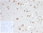 IHC staining of FFPE human brain tissue with Osteopontin antibody (clone OSP/4589). Negative control inset: PBS instead of primary antibody to control for secondary binding.