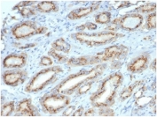 IHC staining of FFPE human prostate with Osteopontin antibody (clone OSP/4589) at 2ug/ml in PBS. HIER: boil tissue sections in pH 9 10mM Tris with 1mM EDTA for 20 min and allow to cool before testing.