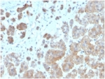 IHC staining of FFPE human adrenal gland with IL1B antibody (clone IL1B/3993). HIER: boil tissue sections in pH 9 10mM Tris with 1mM EDTA for 20 min and allow to cool before testing.