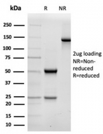 SDS-PAGE analysis of purified, BSA-free Alpha Fodrin antibody (clone SPTAN1/3506) as confirmation of integrity and purity.