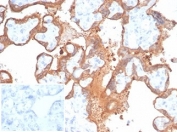 IHC staining of FFPE human placental tissue with recombinant Transglutaminase 2 antibody (clone TGM2/6943R). Negative control inset: PBS instead of primary antibody to control for secondary binding. HIER: boil tissue sections in pH 9 10mM Tris with 1mM EDTA for 20 min and allow to cool before testing.