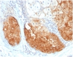 IHC staining of FFPE human skin tissue with Tyrosinase antibody (clone TYR/3826) at 2ug/ml. HIER: boil tissue sections in pH 9 10mM Tris with 1mM EDTA for 20 min and allow to cool before testing.