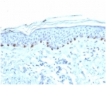IHC staining of FFPE human skin with Tyrosinase antibody (clone TYR/3826) at 2ug/ml. HIER: boil tissue sections in pH 9 10mM Tris with 1mM EDTA for 20 min and allow to cool before testing.