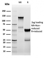 SDS-PAGE analysis of purified, BSA-free recombinant ZAP70 antibody (clone ZAP70/6492R) as confirmation of integrity and purity.