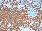 IHC staining of FFPE human tonsil tissue with recombinant ZAP70 antibody (clone ZAP70/6492R). HIER: boil tissue sections in pH 9 10mM Tris with 1mM EDTA for 20 min and allow to cool before testing.