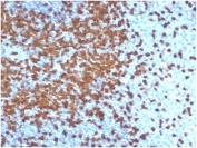 IHC staining of FFPE human tonsil tissue with recombinant ZAP70 antibody (clone ZAP70/6492R). HIER: boil tissue sections in pH 9 10mM Tris with 1mM EDTA for 20 min and allow to cool before testing.