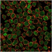 Immunofluorescent staining of PFA-fixed human K562 cells Chk2 antibody (green, clone PCRP-CHEK2-1A4) and phalloidin (red).