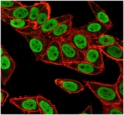 Immunofluorescent staining of PFA-fixed human HeLa cells using Chk2 antibody (green, clone PCRP-CHEK2-1A4) and phalloidin (red).