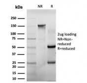 SDS-PAGE analysis of purified, BSA-free Chk2 antibody (clone PCRP-CHEK2-1A4) as confirmation of integrity and purity.