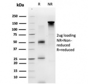 SDS-PAGE analysis of purified, BSA-free ECD antibody (clone PCRP-ECD-1D10) as confirmation of integrity and purity.