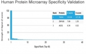 Analysis of HuProt(TM) microarray containing more than 19,000 full-length human proteins using TADA1 antibody (clone PCRP-TADA1-1C9). These results demonstrate the foremost specificity of the PCRP-TADA1-1C9 mAb. Z- and S- score: The Z-score represents the strength of a signal that an antibody (in combination with a fluorescently-tagged anti-IgG secondary Ab) produces when binding to a particular protein on the HuProt(TM) array. Z-scores are described in units of standard deviations (SD's) above the mean value of all signals generated on that array. If the targets on the HuProt(TM) are arranged in descending order of the Z-score, the S-score is the difference (also in units of SD's) between the Z-scores. The S-score therefore represents the relative target specificity of an Ab to its intended target.