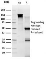 SDS-PAGE analysis of purified, BSA-free TADA1 antibody (clone PCRP-TADA1-1C9) as confirmation of integrity and purity.