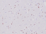 IHC staining of FFPE human cerebrum tissue with recombinant NeuN antibody (clone NeuN/6694R). HIER: boil tissue sections in pH 9 10mM Tris with 1mM EDTA for 20 min and allow to cool before testing.