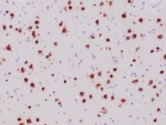 IHC staining of FFPE human ganglioma tissue with recombinant NeuN antibody (clone NeuN/6694R). HIER: boil tissue sections in pH 9 10mM Tris with 1mM EDTA for 20 min and allow to cool before testing.