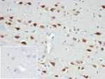 IHC staining of FFPE human brain tissue with recombinant NeuN antibody (clone NeuN/6694R). Negative control inset: PBS used instead of primary antibody to control for secondary Ab binding.