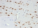 IHC staining of FFPE human brain tissue with recombinant NeuN antibody (clone NeuN/6694R). Negative control inset: PBS used instead of primary antibody to control for secondary Ab binding.