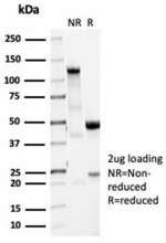 SDS-PAGE analysis of purified, BSA-free recombinant Vinculin antibody (clone VCL/7091R) as confirmation of integrity and purity.