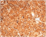 IHC staining of FFPE human pancreas with recombinant Vinculin antibody (clone VCL/7091R) at 2ug/ml. HIER: boil tissue sections in pH 9 10mM Tris with 1mM EDTA for 20 min and allow to cool before testing.