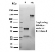 SDS-PAGE analysis of purified, BSA-free recombinant VIM antibody (clone rVIM/6914) as confirmation of integrity and purity.