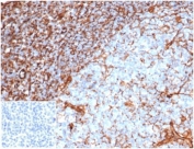 IHC staining of FFPE human tonsil tissue with recombinant VIM antibody (clone rVIM/6914). Negative control inset: PBS instead of primary antibody to control for secondary binding. HIER: boil tissue sections in pH 9 10mM Tris with 1mM EDTA for 20 min and allow to cool before testing.