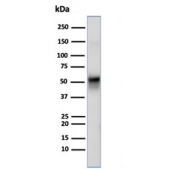 Western blot testing of human U-87 MG cell lysate using recombinant VIM antibody (clone rVIM/6914). Predicted molecular weight ~53 kDa.