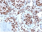 IHC staining of FFPE human testis tissue with INI1 antibody (clone SMARCB1/3984) at 2ug/ml. Negative control inset: PBS instead of primary antibody to control for secondary binding. HIER: boil tissue sections in pH 9 10mM Tris with 1mM EDTA for 20 min and allow to cool before testing.