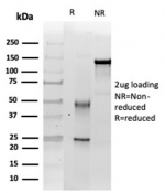 SDS-PAGE analysis of purified, BSA-free INI1 antibody (clone SMARCB1/3984) as confirmation of integrity and purity.