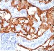IHC staining of FFPE human placental tissue with Transglutaminase 2 antibody (clone TGM2/3612). Negative control inset: PBS instead of primary antibody to control for secondary binding. HIER: boil tissue sections in pH 9 10mM Tris with 1mM EDTA for 20 min and allow to cool before testing.