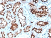 IHC staining of FFPE human kidney tissue with Angiotensin Converting Enzyme antibody (clone ACE/3764) at 2ug/ml in PBS for 30min RT. HIER: boil tissue sections in pH 9 10mM Tris with 1mM EDTA for 20 min and allow to cool before testing.