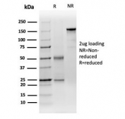 SDS-PAGE analysis of purified, BSA-free Decapping Protein 2 antibody (clone PCRP-DCP2-1D6) as confirmation of integrity and purity.
